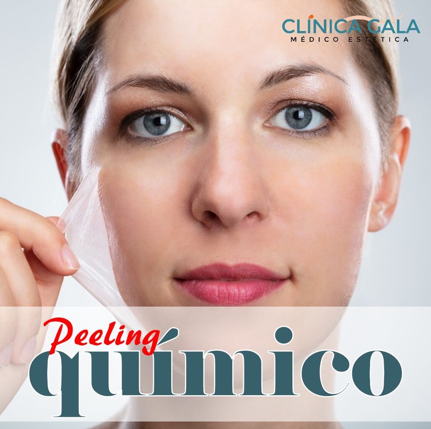 peeling quimico