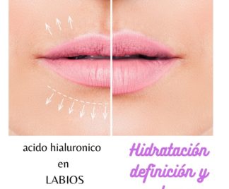 relleno labios