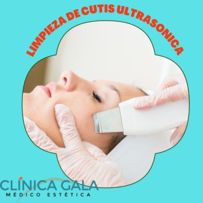 LIMPIEZA ULTRASONICA