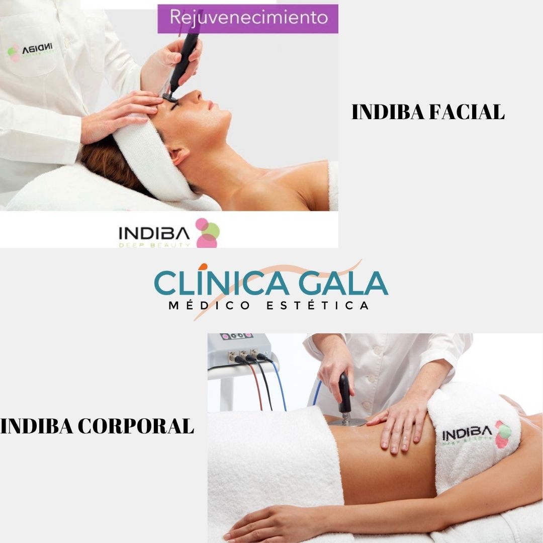 INDIBA FACIAL Y CORPORAL