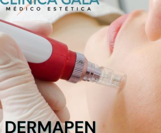 DERMAPEN MICROPUNCIÓN