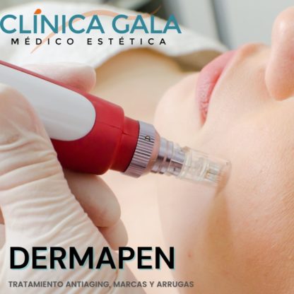 DERMAPEN MICROPUNCIÓN