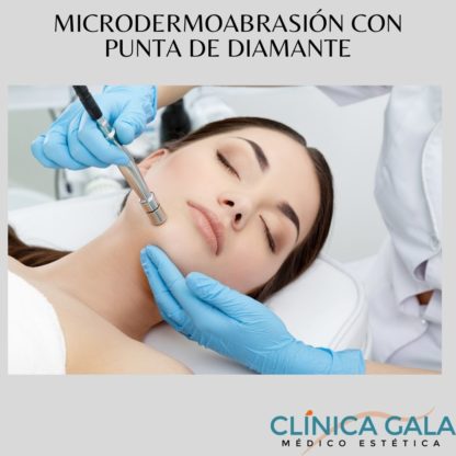 MICRODERMOABRASIÓN CON PUNTA DIAMANTE