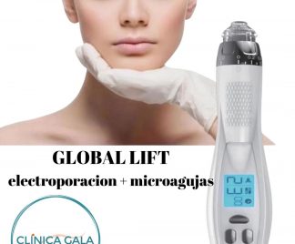 global lift electroporación