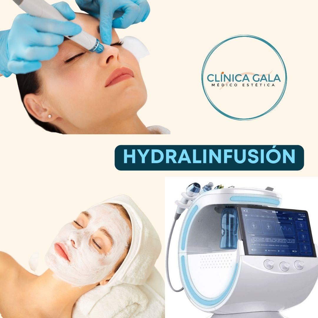 HYDRAFACIAL