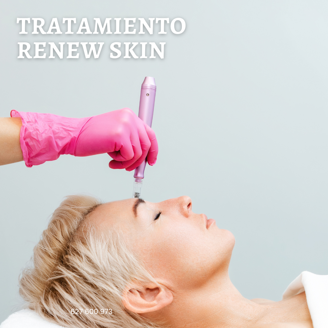 renew skin dermapen